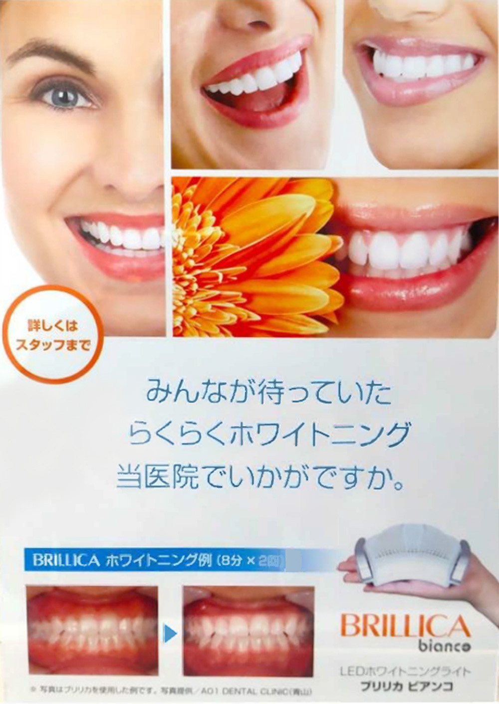 みんなが待っていた らくらくホワイトニング 当医院でいかがですか。
